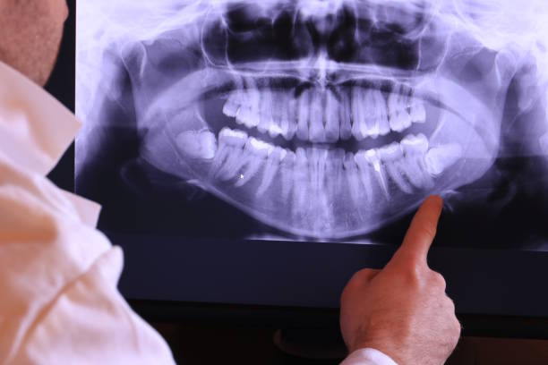 Reliable ND Emergency Dentist Solutions