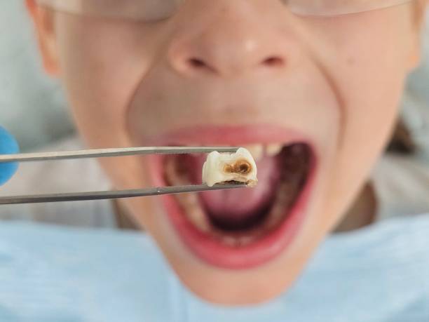 Best Emergency Dental Surgery in Harvey, ND